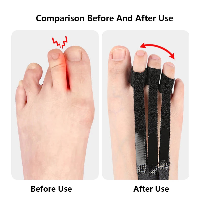 Plantar Fasciitis Dorsal Night & Day Splint